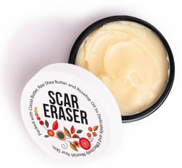 scar cream, scar eraser body butter