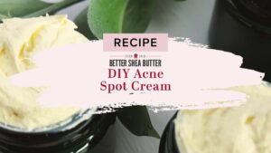 acne spot cream recipe diy