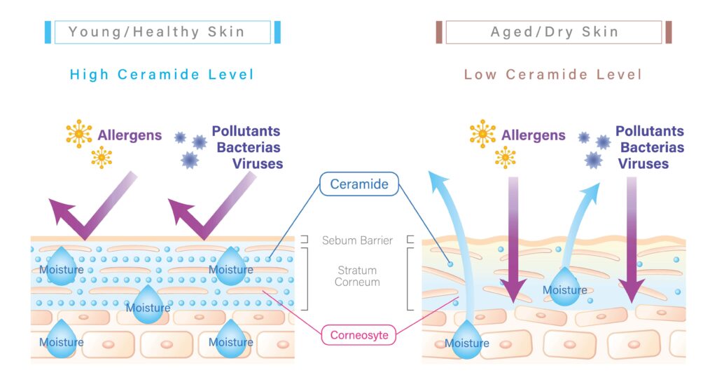 ceramides diagram aging skin