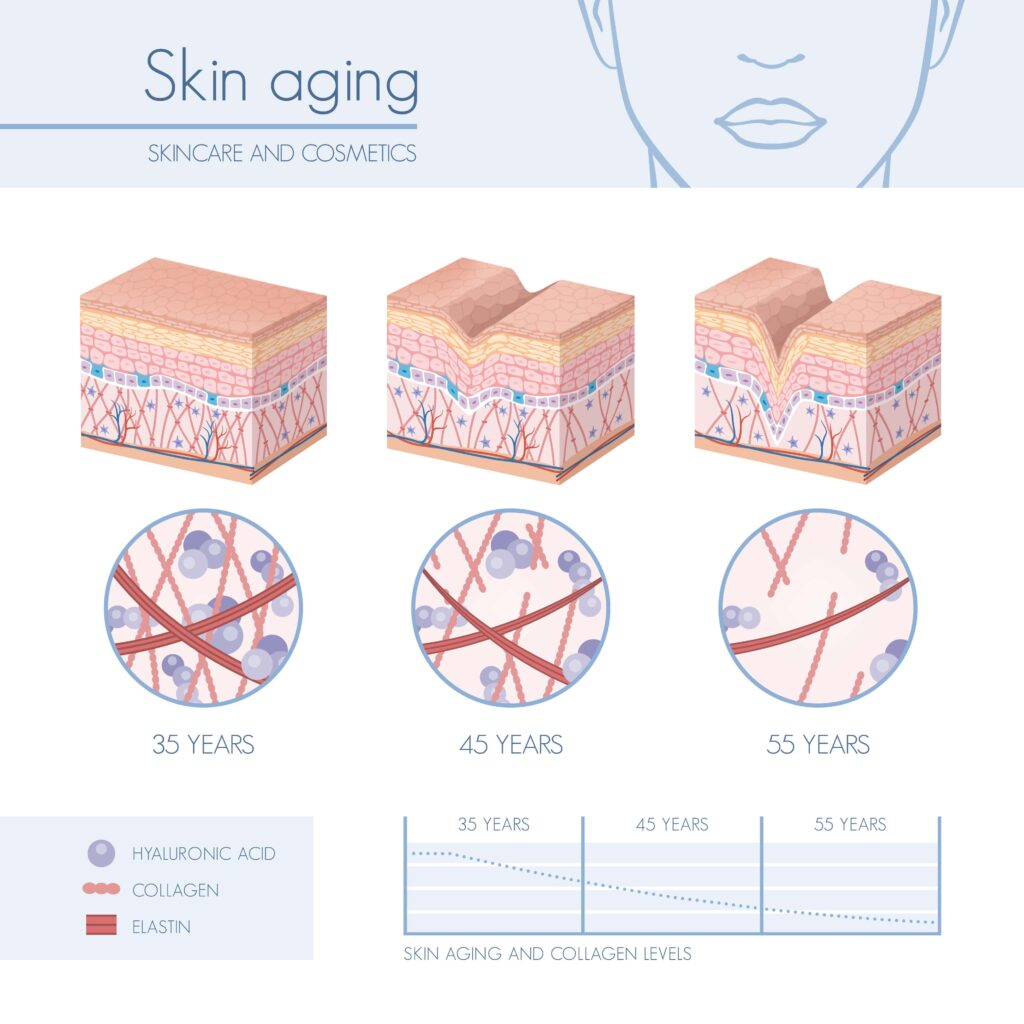skin aging diagram collagen and elastin